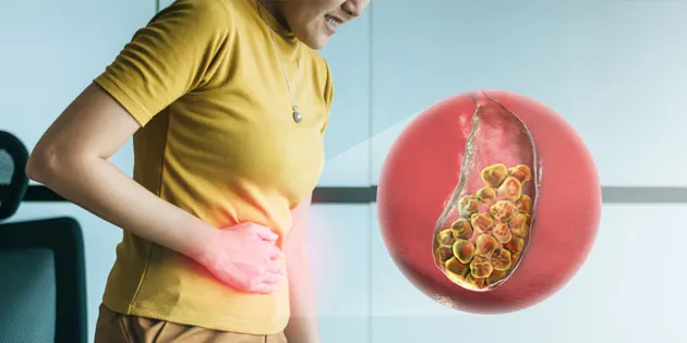 penyebab batu empedu