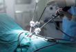 Apa Itu Tindakan Laparoskopi dan Bagaimana Prosedurnya?