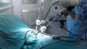 Apa Itu Tindakan Laparoskopi dan Bagaimana Prosedurnya?