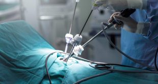 Apa Itu Tindakan Laparoskopi dan Bagaimana Prosedurnya?